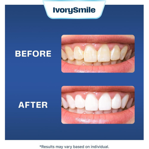 Відбілюючі смужки для зубів IvorySmile Teeth Whitening Strips 40 шт