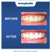 Відбілюючі смужки для зубів IvorySmile Teeth Whitening Strips 40 шт